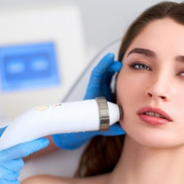 ipl facial treatment
